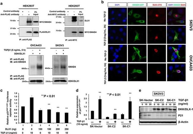 DLX1 Antibody in Western Blot (WB)