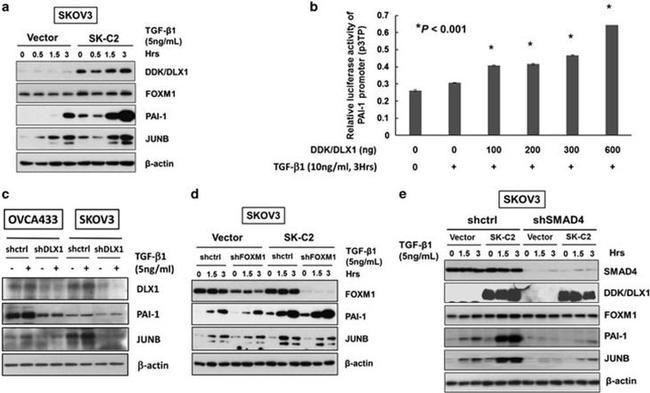 DLX1 Antibody in Western Blot (WB)