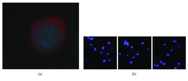 Pan Cytokeratin Antibody in Immunocytochemistry (ICC/IF)