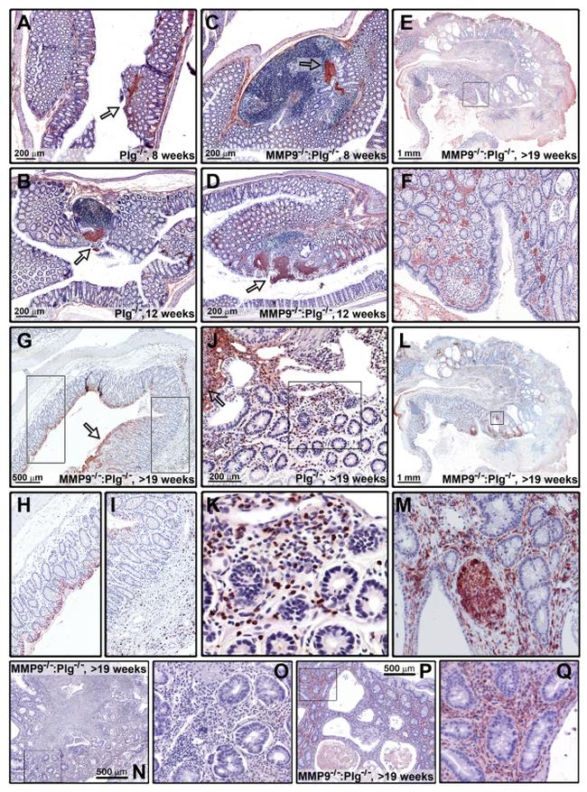 Ly-6G/Ly-6C Antibody in Immunohistochemistry (Paraffin) (IHC (P))