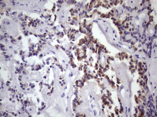 DMRT1 Antibody in Immunohistochemistry (Paraffin) (IHC (P))