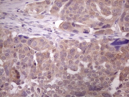 DMRT1 Antibody in Immunohistochemistry (Paraffin) (IHC (P))