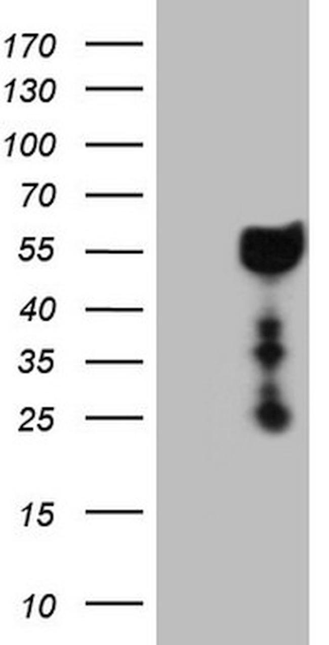 DMRT1 Antibody in Western Blot (WB)