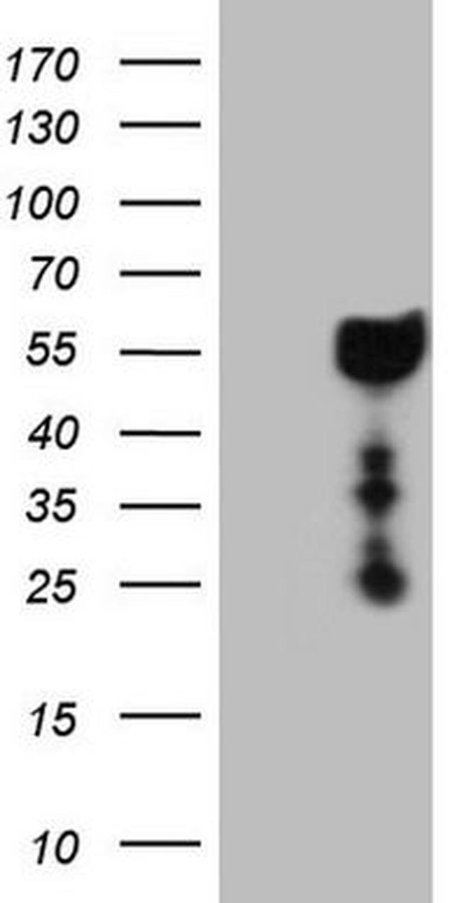 DMRT1 Antibody in Western Blot (WB)