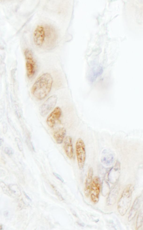 DNA Ligase 1 Antibody in Immunohistochemistry (IHC)