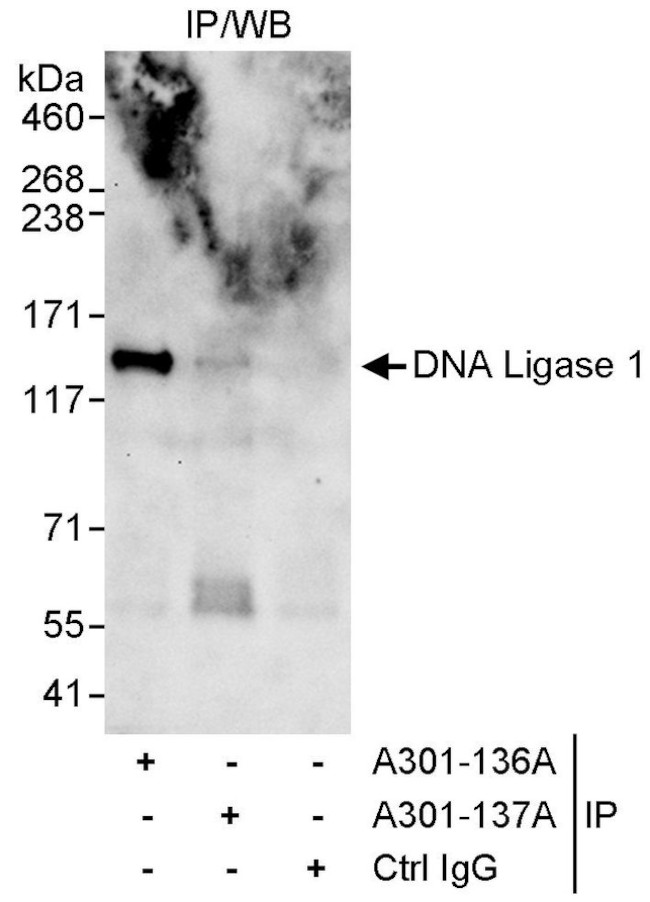 DNA Ligase 1 Antibody in Immunoprecipitation (IP)