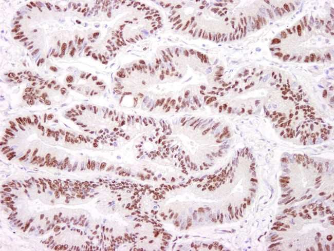 DNA-PKcs Antibody in Immunohistochemistry (IHC)