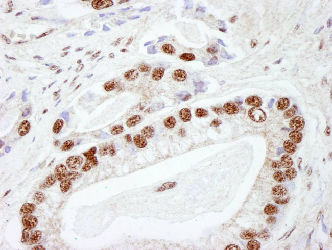 DNA-PKcs Antibody in Immunohistochemistry (IHC)