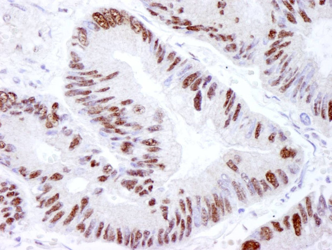 DNA-PKcs Antibody in Immunohistochemistry (IHC)