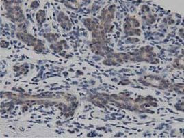 DNAJA2 Antibody in Immunohistochemistry (Paraffin) (IHC (P))