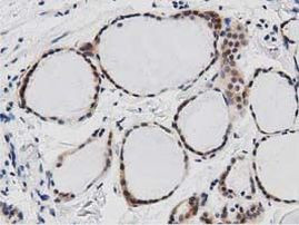 DNAJA2 Antibody in Immunohistochemistry (Paraffin) (IHC (P))