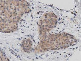 DNAJA2 Antibody in Immunohistochemistry (Paraffin) (IHC (P))