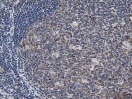 DNAJA2 Antibody in Immunohistochemistry (Paraffin) (IHC (P))