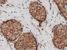 DNAJA2 Antibody in Immunohistochemistry (Paraffin) (IHC (P))