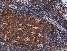 DNAJA2 Antibody in Immunohistochemistry (Paraffin) (IHC (P))