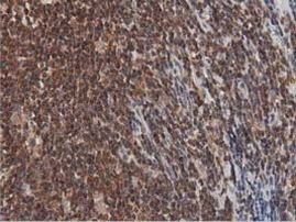 DNAJA2 Antibody in Immunohistochemistry (Paraffin) (IHC (P))