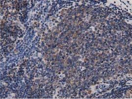 DNAJA2 Antibody in Immunohistochemistry (Paraffin) (IHC (P))