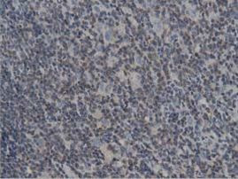 DNAJA2 Antibody in Immunohistochemistry (Paraffin) (IHC (P))