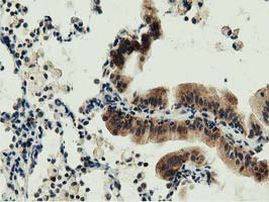 DNAJA2 Antibody in Immunohistochemistry (Paraffin) (IHC (P))