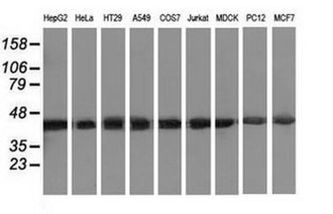 DNAJA2 Antibody in Western Blot (WB)