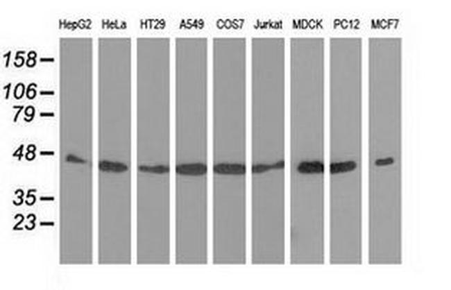 DNAJA2 Antibody in Western Blot (WB)