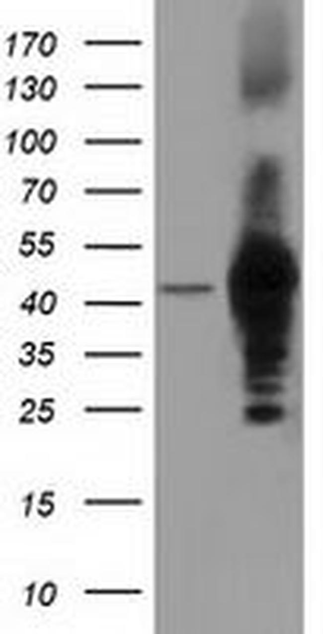 DNAJA2 Antibody in Western Blot (WB)