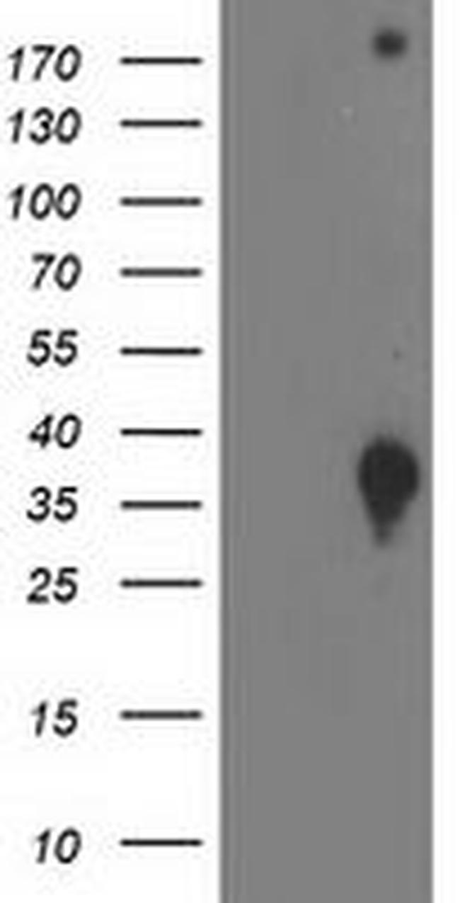 DNAJB2 Antibody in Western Blot (WB)