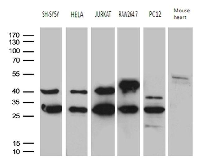 DNAJB6 Antibody in Western Blot (WB)