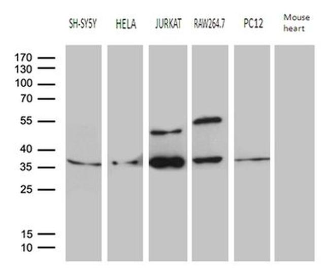 DNAJB6 Antibody in Western Blot (WB)