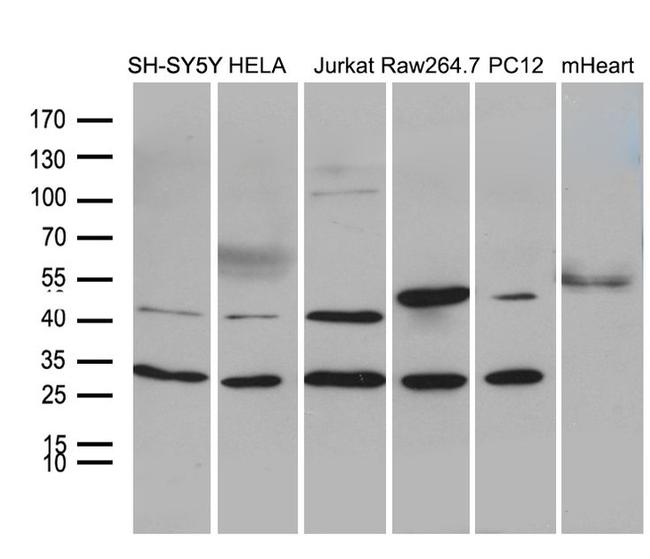 DNAJB6 Antibody in Western Blot (WB)