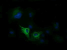 DNM1L Antibody in Immunocytochemistry (ICC/IF)