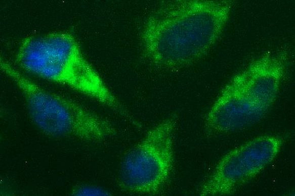 DNM1L Antibody in Immunocytochemistry (ICC/IF)