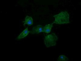 DNM1L Antibody in Immunocytochemistry (ICC/IF)