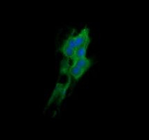 DNM1L Antibody in Immunocytochemistry (ICC/IF)