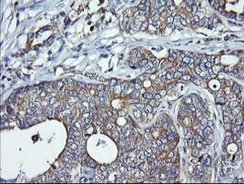 DNM1L Antibody in Immunohistochemistry (Paraffin) (IHC (P))