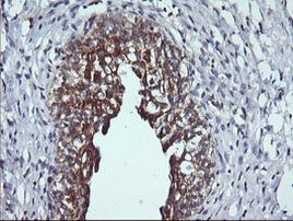 DNM1L Antibody in Immunohistochemistry (Paraffin) (IHC (P))