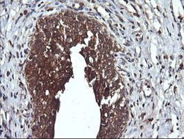 DNM1L Antibody in Immunohistochemistry (Paraffin) (IHC (P))