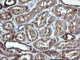 DNM1L Antibody in Immunohistochemistry (Paraffin) (IHC (P))