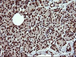 DNM1L Antibody in Immunohistochemistry (Paraffin) (IHC (P))