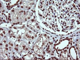 DNM1L Antibody in Immunohistochemistry (Paraffin) (IHC (P))