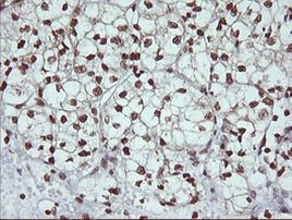 DNM1L Antibody in Immunohistochemistry (Paraffin) (IHC (P))