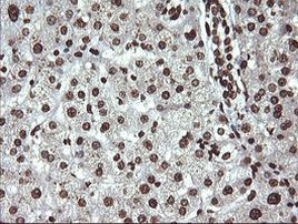 DNM1L Antibody in Immunohistochemistry (Paraffin) (IHC (P))