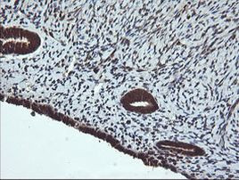 DNM1L Antibody in Immunohistochemistry (Paraffin) (IHC (P))