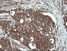 DNM1L Antibody in Immunohistochemistry (Paraffin) (IHC (P))