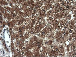 DNM1L Antibody in Immunohistochemistry (Paraffin) (IHC (P))