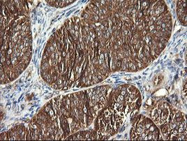 DNM1L Antibody in Immunohistochemistry (Paraffin) (IHC (P))