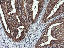 DNM1L Antibody in Immunohistochemistry (Paraffin) (IHC (P))