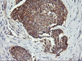 DNM1L Antibody in Immunohistochemistry (Paraffin) (IHC (P))