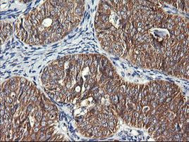 DNM1L Antibody in Immunohistochemistry (Paraffin) (IHC (P))