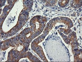 DNM1L Antibody in Immunohistochemistry (Paraffin) (IHC (P))